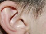 Morso orecchio