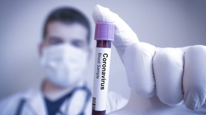 coronavirus provetta1