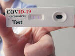 Coronavirus test sierologici dal 21 aprile Poliambulanza già all opera
