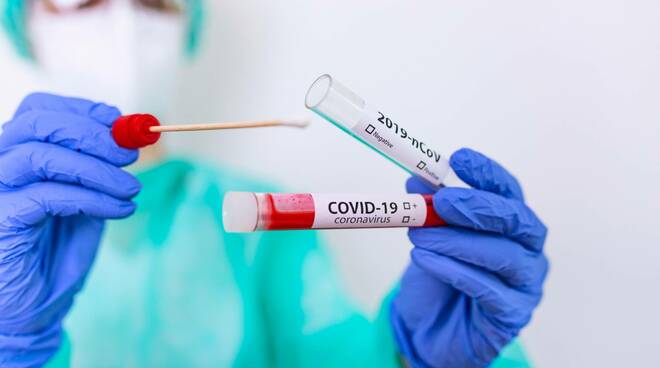 coronavirus tampone analisi