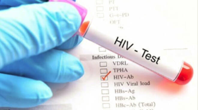 hiv test